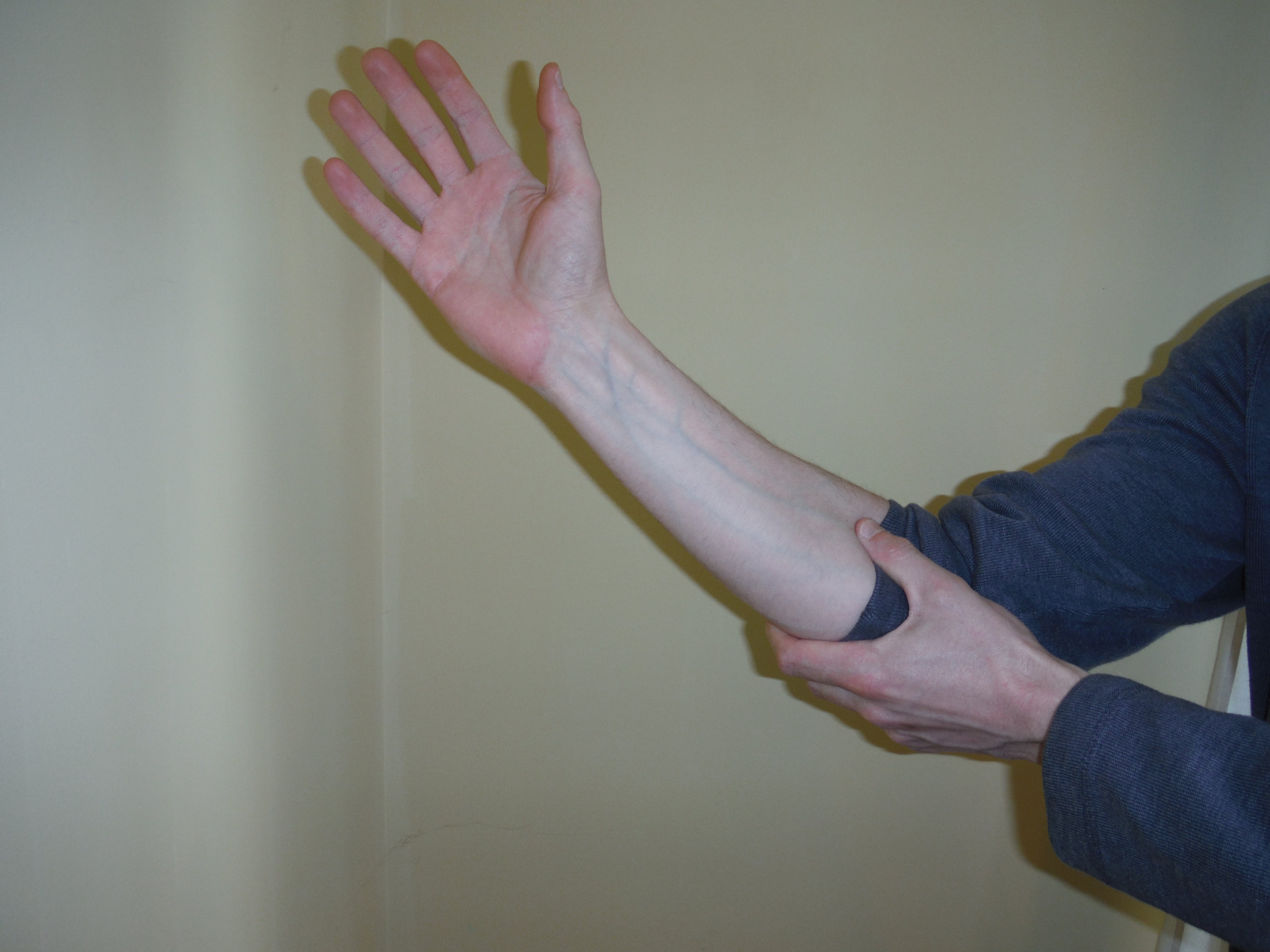Cubital Tunnel Syndrome Sports Rehab & Wellness