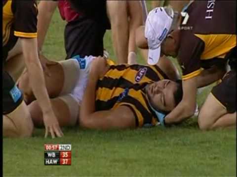 Should athletes continue to play after a concussion?