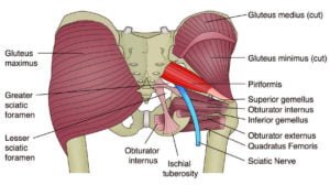 Piriformis Syndrome and Sciatica Sciatica and Piriformis Syndrome